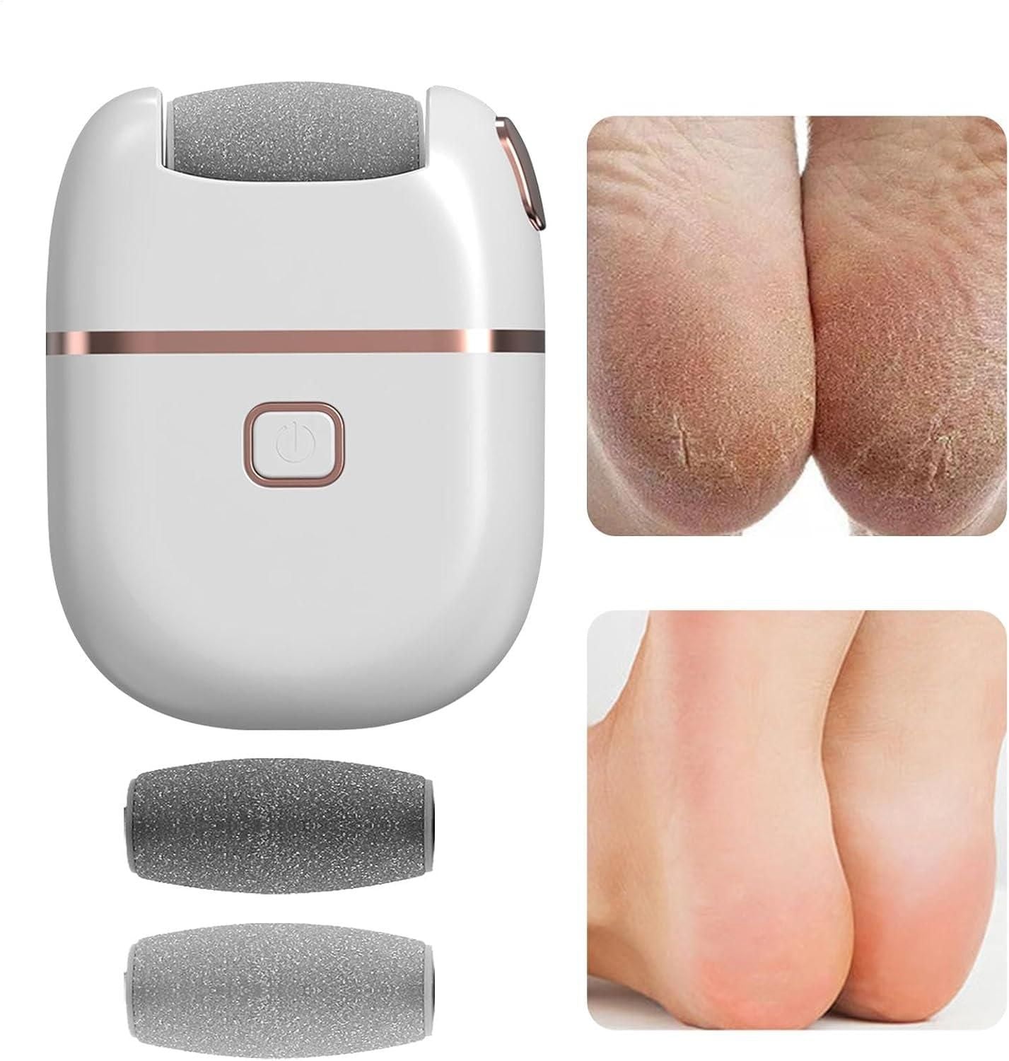 Electronic Pedicure Tool-Salon Soft Feet at Home